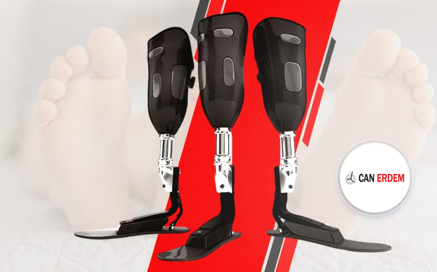 Çocuk Protezleri'nin Psikolojik ve Sosyal Etkileri